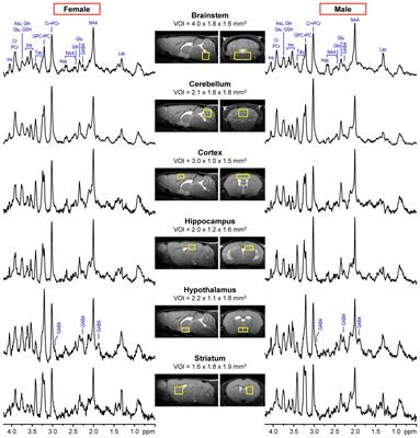 Regional sex differences in neurochemical profiles of healthy mice measured by magnetic resonance spectroscopy at 9.4 tesla